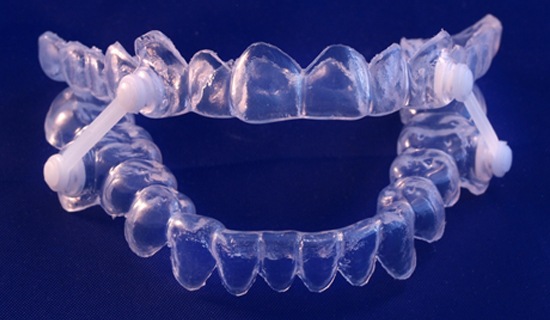 Oral Appliance Therapy Mangum| Sleep Apnea | 333 Dental Care